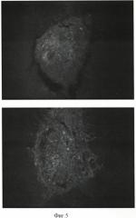 Способ получения популяции стромальных клеток жировой ткани, индуцированных к нейральной дифференцировке (патент 2396345)