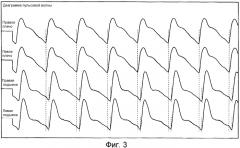 Устройство для анализа пульсовой волны и носитель записи (патент 2570282)