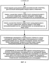 Система для осуществления локализации передней крестообразной связки с применением визуализации (патент 2575055)