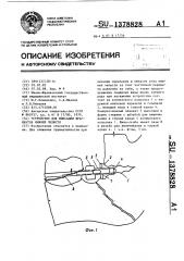 Устройство для фиксации фрагментов нижней челюсти (патент 1378828)