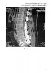 Способ коррекции деформаций поясничного отдела позвоночника (патент 2621170)