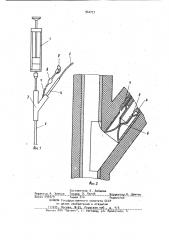 Устройство для катетеризации сосудов (патент 942771)