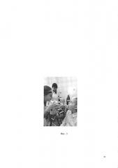 Способ лечения аденориносинуситов (патент 2662925)