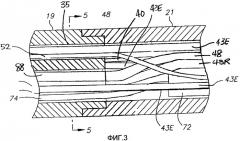 Катетер с всенаправленным оптическим наконечником, обладающий изолированными оптическими путями (патент 2491014)