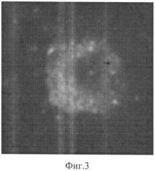 Способ лазерного фототермолиза серповидно-клеточных эритроцитов (патент 2345805)