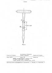 Игла для акупунктуры (патент 1296164)