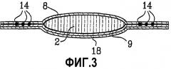 Поглощающее изделие, содержащее эластичный ламинат (патент 2345747)