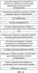 Терапевтическая система на основе сфокусированного ультразвука (патент 2366475)