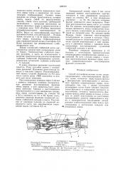 Способ аутонейропластики (патент 1286181)