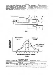 Способ лечения больных с остеомиелитом конечности (патент 1482716)
