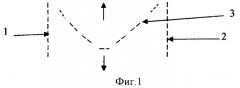 Способ рассечения передней продольной связки позвоночника на уровне экстирпации полупозвонка в сочетании с коррекцией деформации позвоночника (патент 2355336)