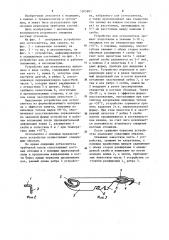 Устройство для остеосинтеза (патент 1205901)