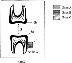 Устройство для диагностики и лечения бруксизма (патент 2482890)