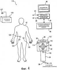 Способ и устройство для отслеживания положения терапевтического ультразвукового преобразователя (патент 2492884)