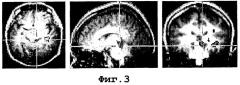 Функциональная визуализация головного мозга для обнаружения и оценки обмана и скрытого признания, и когнитивной/эмоциональной реакции на информацию (патент 2296508)