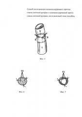 Способ изготовления клапаносодержащего протеза ствола легочной артерии и клапаносодержащий протез ствола легочной артерии, изготовленный этим способом (патент 2644502)