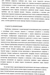 Система и способ продувки устройства пониженного давления во время лечения путем подачи пониженного давления (патент 2404822)