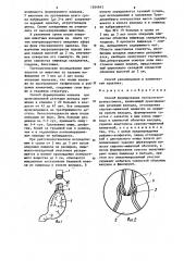 Способ формирования эзофагогастроанастомоза (патент 1264943)