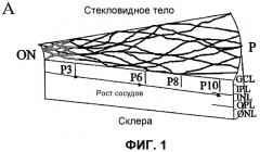 Изолированные популяции миелоидоподобных клеток костного мозга и способы лечения с ними (патент 2418856)