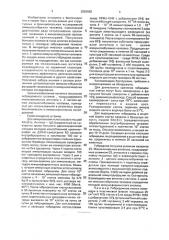 Штамм гибридных культивируемых клеток животных mus musculus l. - продуцент моноклональных антител к @ -легким цепям иммуноглобулинов человека (патент 2003682)