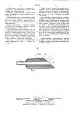 Хирургический шовный материал (патент 1034726)
