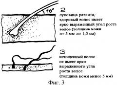 Способ стрижки волос грибанова (патент 2428087)