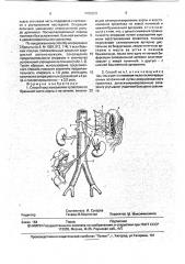 Способ восстановления кровотока по брюшной части аорты и ее ветвям (патент 1792323)