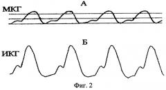 Способ регистрации механической работы изолированного сердца лягушки (патент 2479871)