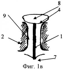 Внутриносовая шина (варианты) и способ ее фиксации (патент 2414180)