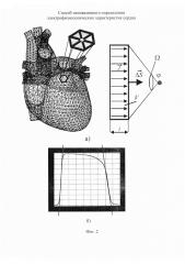Способ неинвазивного определения электрофизиологических характеристик сердца (патент 2615286)