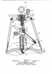 Устройство для обработки костной ткани (патент 1149950)