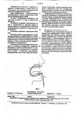 Устройство для отсасывания слюны из полости рта (патент 1713574)