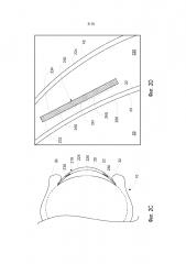 Микроэлектроды в офтальмическом электрохимическом датчике (патент 2611557)