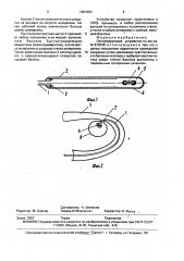 Оккмозирующее устройство (патент 1681864)
