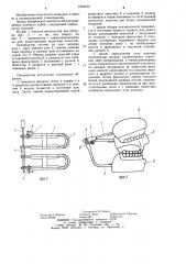Окклюдатор (патент 1242153)