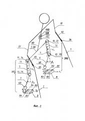 Аппарат помощи при ходьбе человеку с нарушением опорно-двигательных функций (варианты) (патент 2658481)