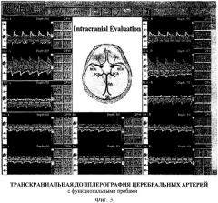 Способ диагностики ранних форм цереброваскулярной недостаточности (патент 2417756)