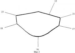 Бескаркасный протез корня аорты (патент 2293543)