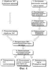 Способ неинвазивного электрофизиологического исследования сердца (патент 2409313)