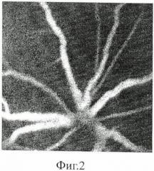 Способ моделирования неоваскуляризации переднего отрезка глаза у крыс (патент 2488891)