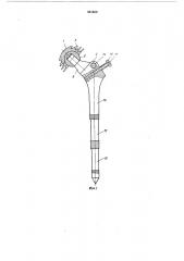 Искусственный тазобедренный сустав (патент 501509)