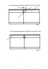 Способ наложения внутрикожного q-образного косметического шва (патент 2661800)