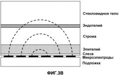 Неинвазивный датчик для определения функциональных характеристик роговицы, устройство, содержащее упомянутый датчик, и его применение (патент 2576370)