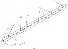 Подъемник передней брюшной стенки с осветителем (патент 2279256)