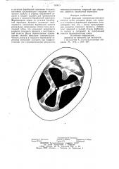 Способ фиксации тимпанопластического лоскута (патент 787013)