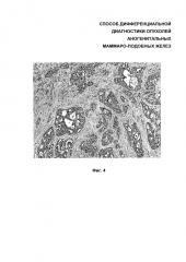 Способ дифференциальной диагностики опухолей аногенитальных маммароподобных желез (патент 2626123)