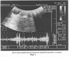 Способ оценки жизнеспособности ободочной кишки (патент 2295293)