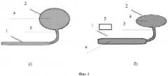 Магнитоуправляемый фаллоэндопротез (патент 2651098)