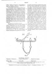 Устройство для лечения свищей прямой кишки (патент 1651873)