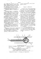 Устройство для снятия биопотенциалов в полых органах (патент 906516)